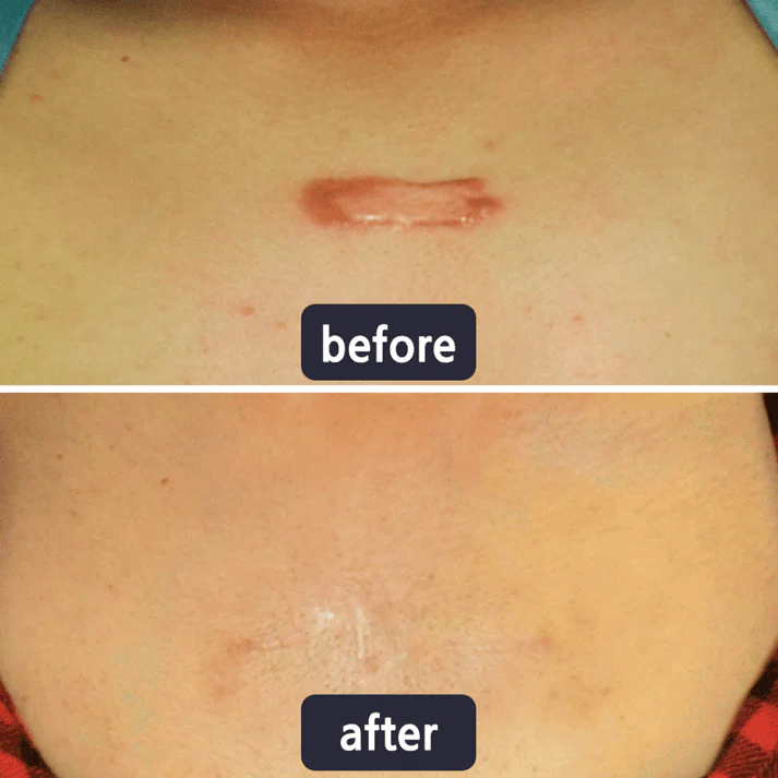 Viralaluna Scar Removal Cream - Image 5