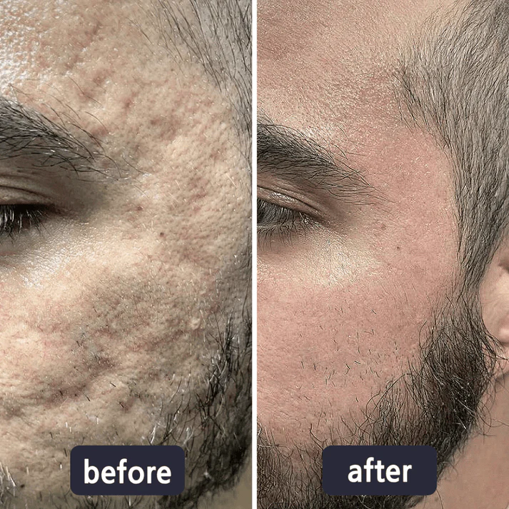 Viralaluna Scar Removal Cream - Image 7