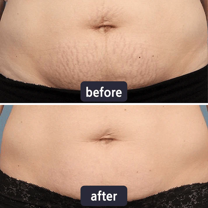 Viralaluna Scar Removal Cream - Image 8