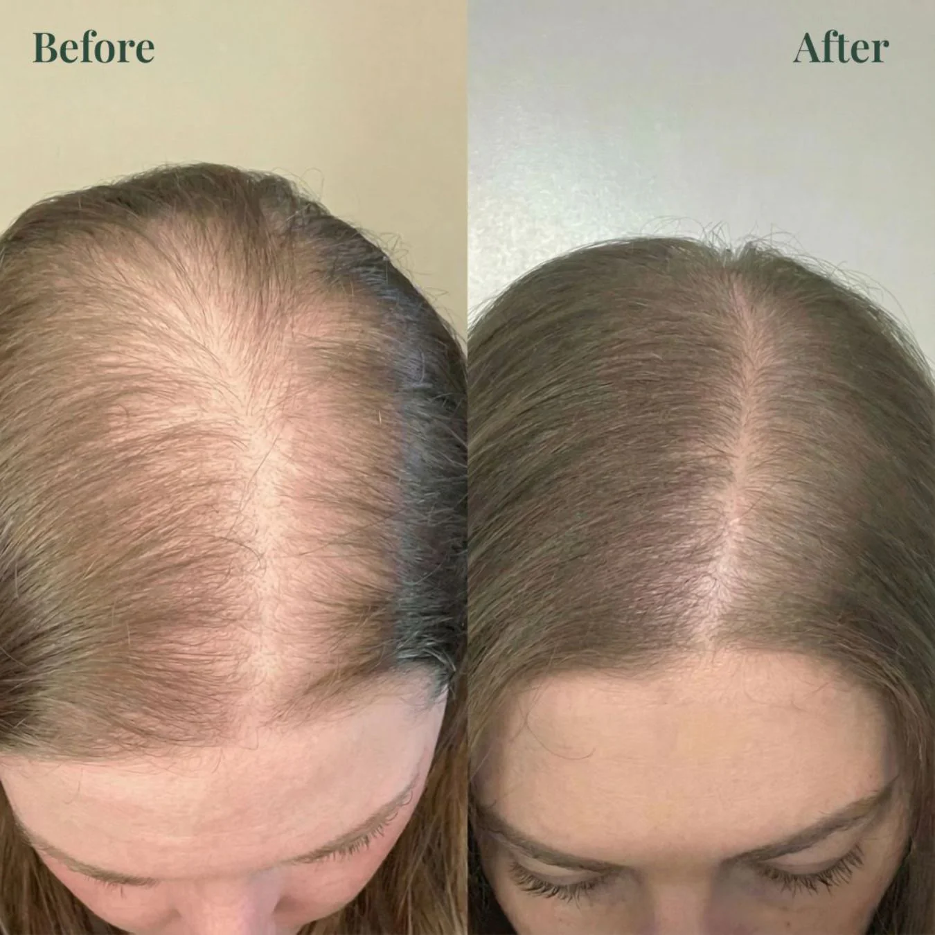 Viralaluna™ Growth-Support Shampoo - 2-Pack - Image 6