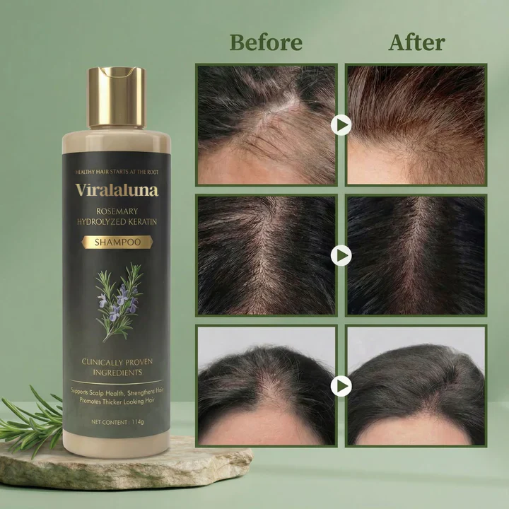 Viralaluna™ Growth-Support Shampoo - 2-Pack - Image 9