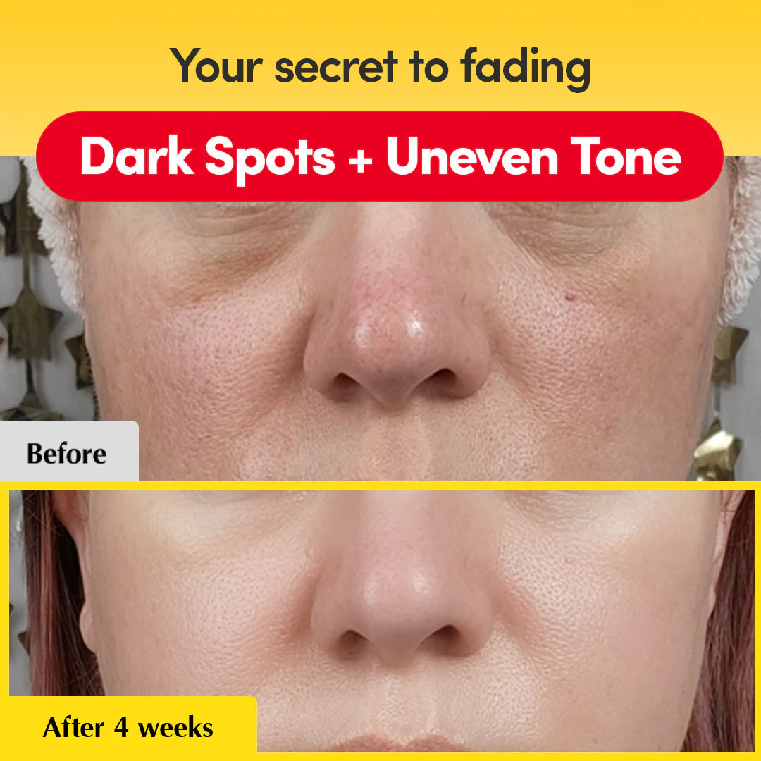 [#1 Solution for Dark Skin] Vitamin Illuminating Serum - Image 2