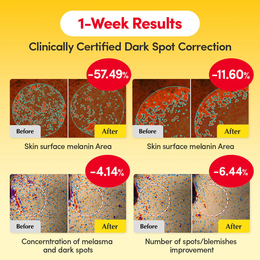 [#1 Solution for Dark Skin] Vitamin Illuminating Serum - Image 3