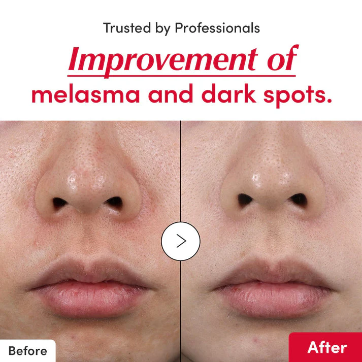 [#1 Solution for Dark Skin] Vitamin Illuminating Serum - Image 6